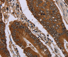 Catenin gamma Polyclonal Antibody - 2