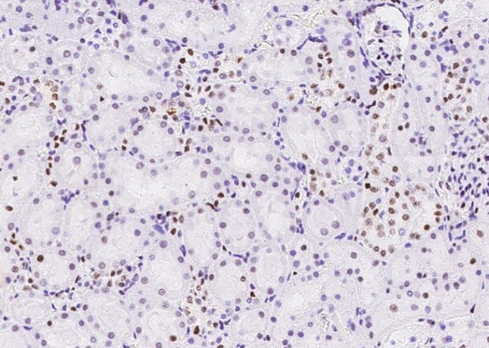 Recombinant MSH6/GTBP Monoclonal Antibody - small - 9