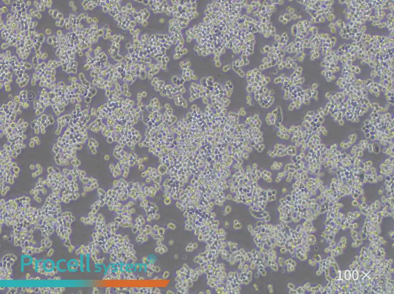 COLO 320DM Cell Complete MediumCOLO 320DM Cell Complete Medium - 3