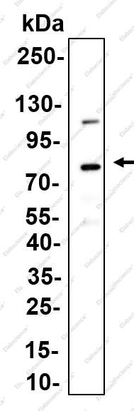 Recombinant PFK-C Monoclonal Antibody - 1
