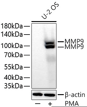 MMP9 Polyclonal Antibody - small - 6