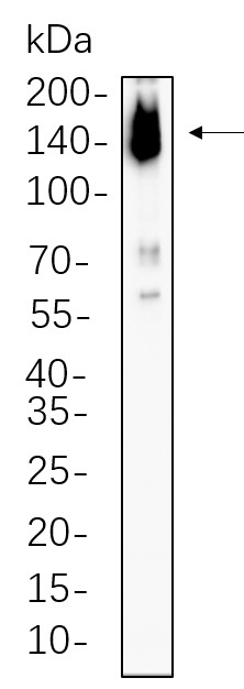 Recombinant ASK1 Monoclonal Antibody-searchlist-1