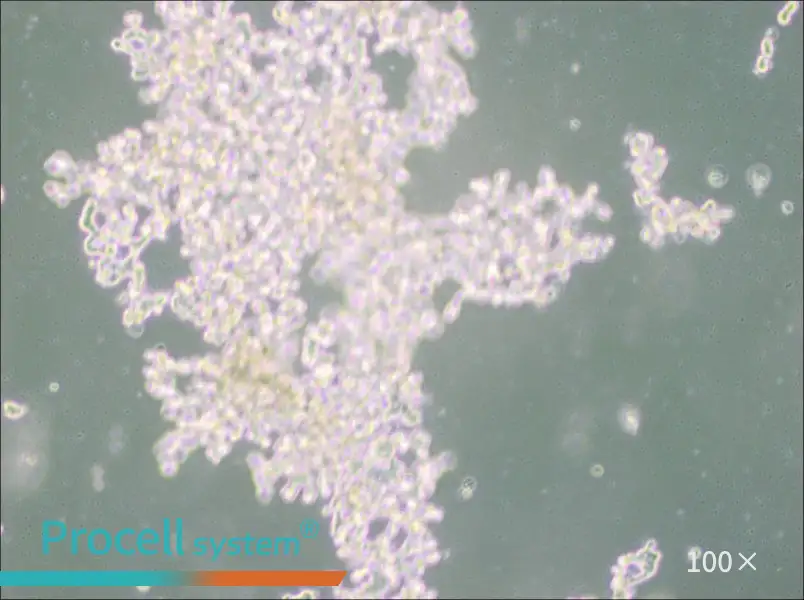 DU4475 Cell Complete Medium - 1