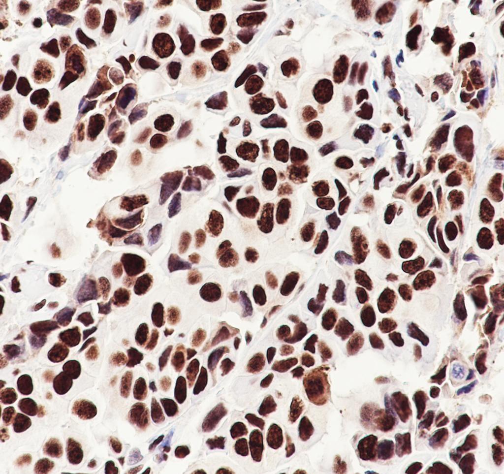 Recombinant Nucleolin Monoclonal Antibody - small - 3