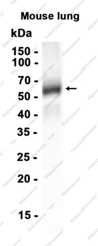 Recombinant CaMKII beta Monoclonal Antibody - 2
