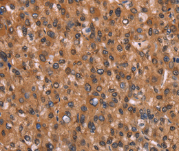 HINT1 Polyclonal Antibody - 3