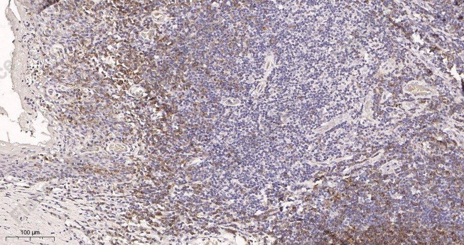 Recombinant CD19 Monoclonal Antibody - 2