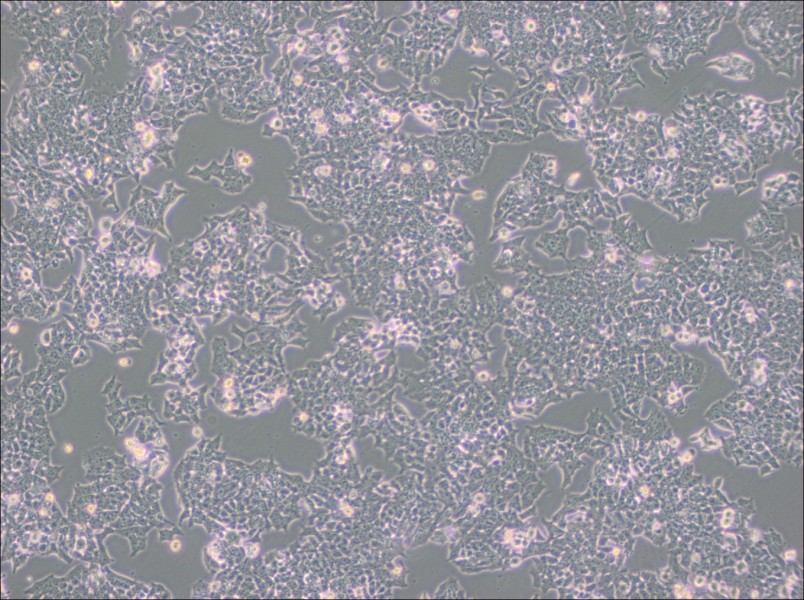 NCI-H520 Cell Complete Medium - 1