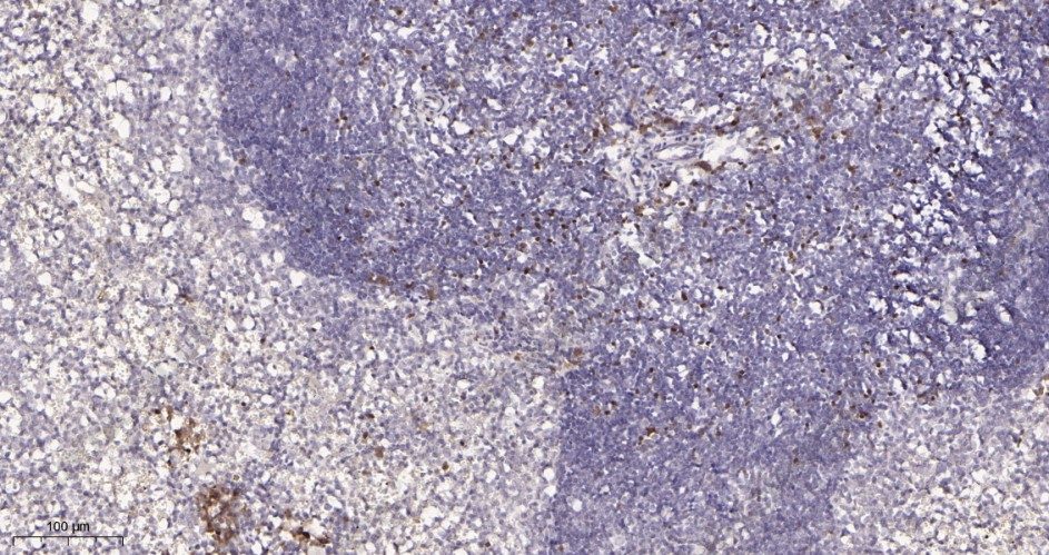 Recombinant FOXP3 Monoclonal Antibody - 3