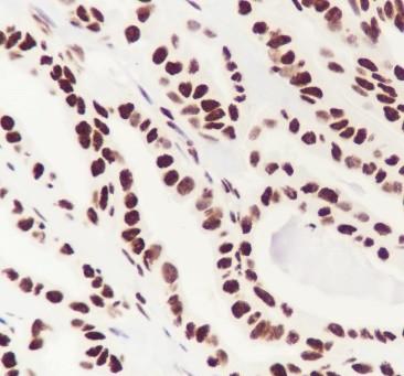 Recombinant DUSP5 Monoclonal Antibody - small - 3
