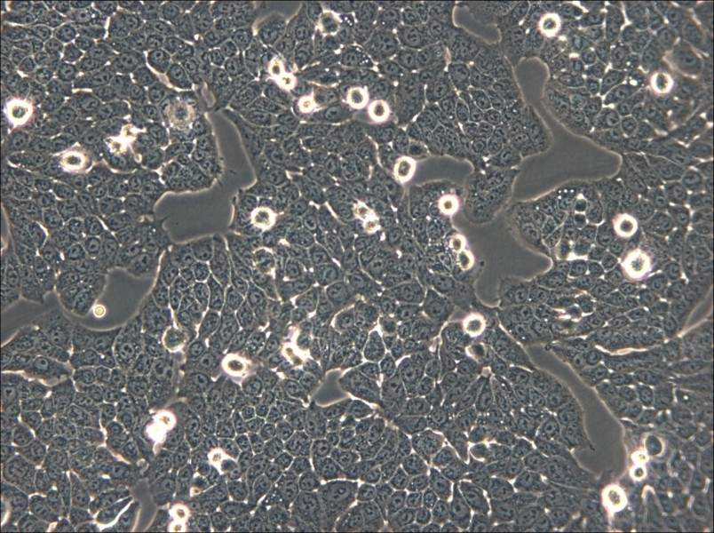 WSU-HN30 Cell Complete Medium - 5