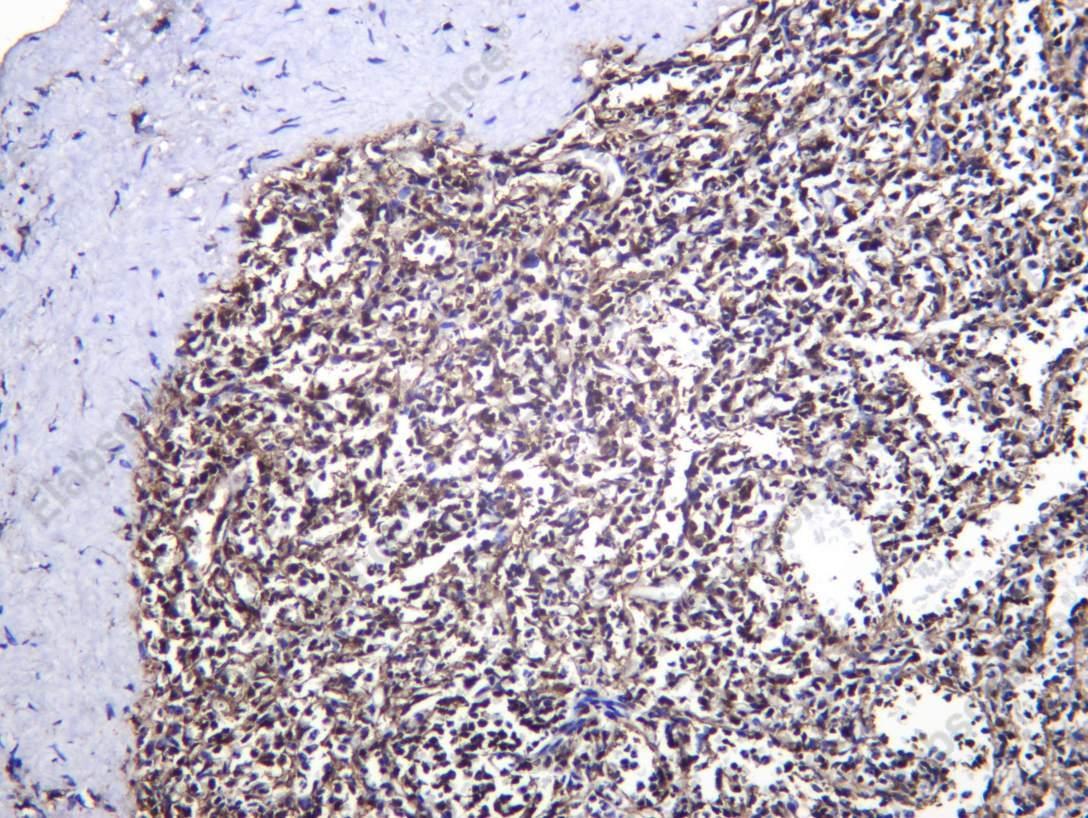 Recombinant PSMB9 Monoclonal Antibody - 1
