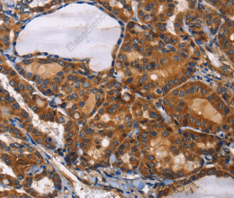ILK Polyclonal Antibody - 2