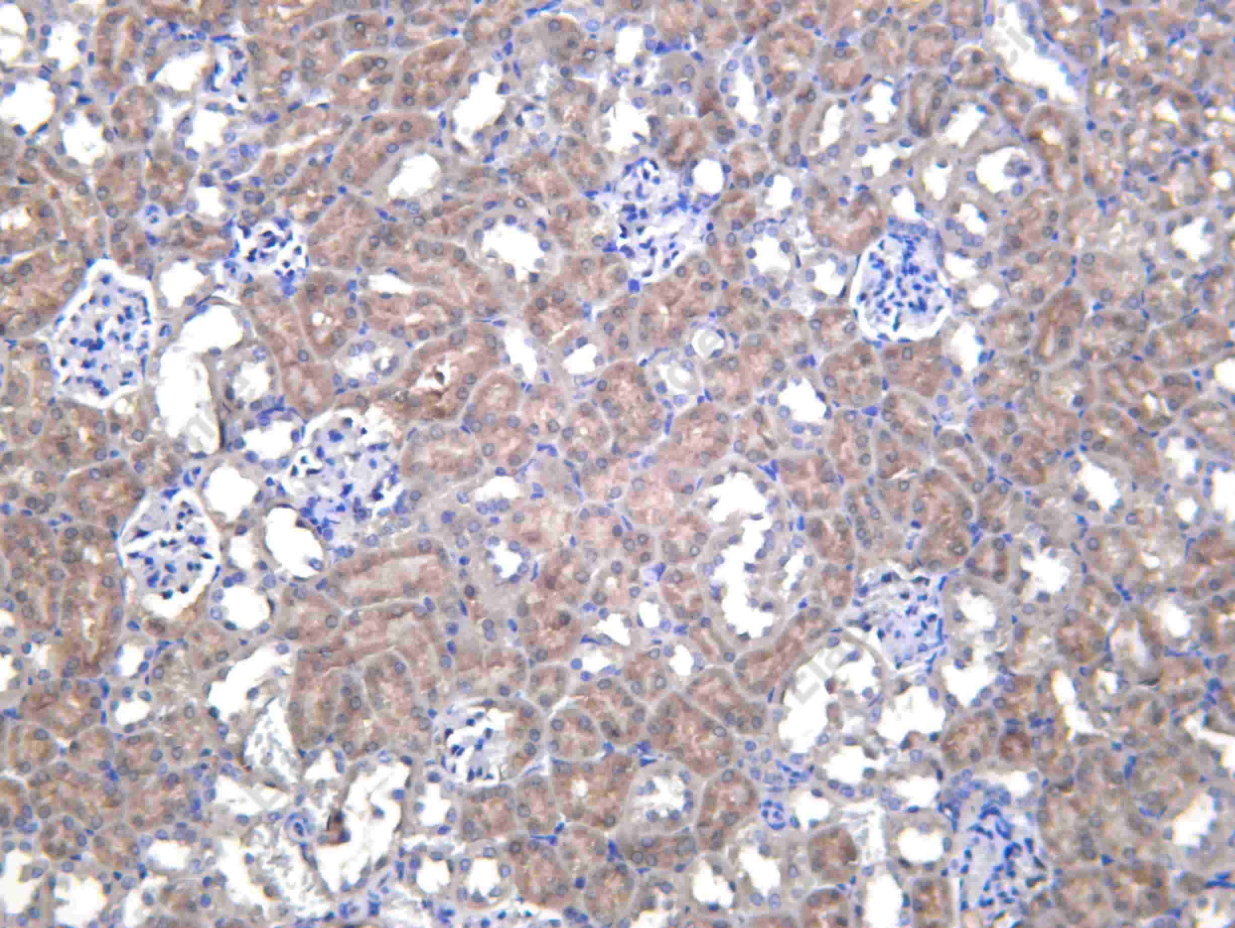 Recombinant ATG9A Monoclonal Antibody - 1
