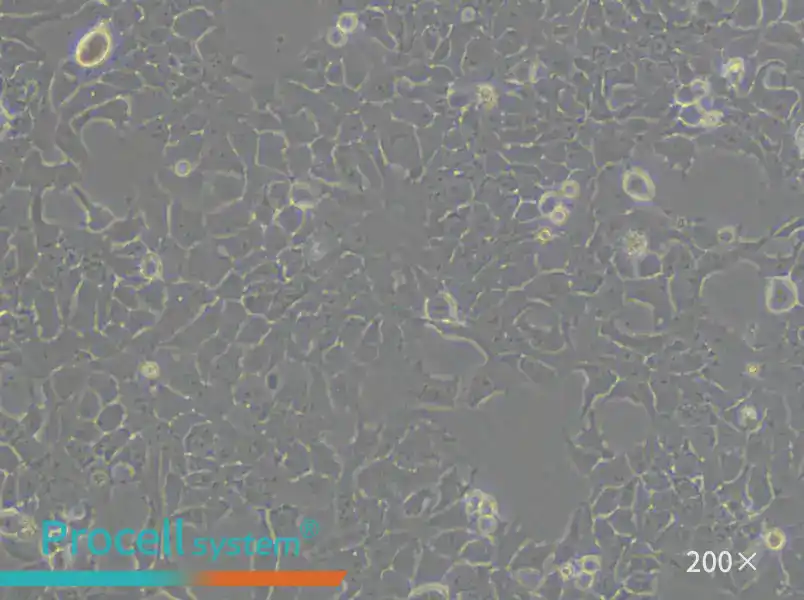 NCI-H322 Cell Complete Medium - 5