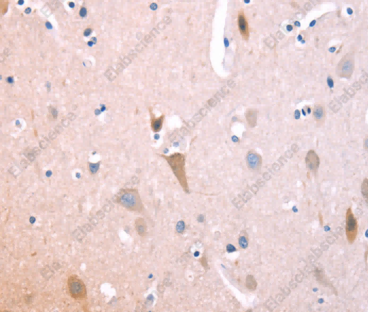 ST2 Polyclonal Antibody - 2