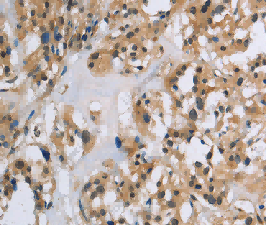 IL5RA Polyclonal Antibody - 2