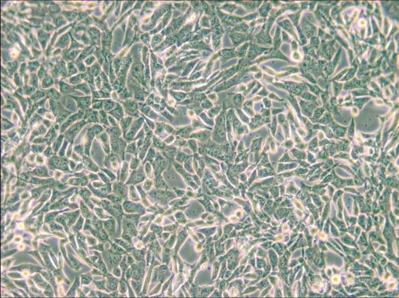 SUM159PT Cell Complete Medium - small - 5