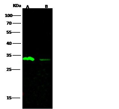 Recombinant Carbonic Anhydrase III/CA3 Monoclonal Antibody - small - 2