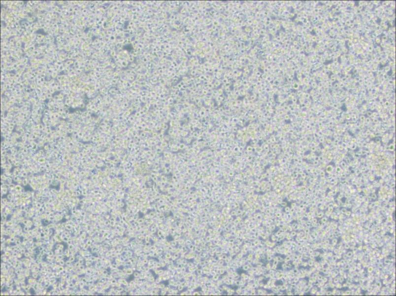 H9 [derivative of HuT 78] Cell Complete MediumH9 [derivative of HuT 78] Cell Complete Medium - 2