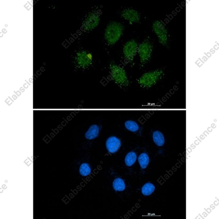 Recombinant Smad3 Monoclonal Antibody - 2