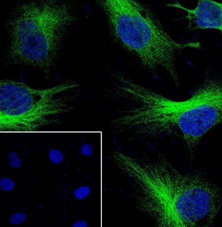 Recombinant alpha Actinin 2 Monoclonal Antibody - small - 7