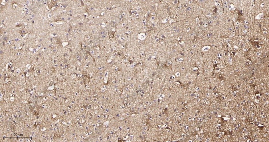 Recombinant Neurofilament heavy polypeptide Monoclonal Antibody - 2
