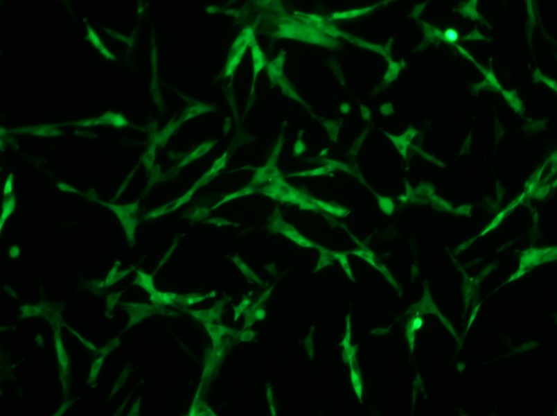 U-87 MG-GFP Cell Complete Medium - 1
