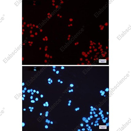 Recombinant MSH6/GTBP Monoclonal Antibody - 5