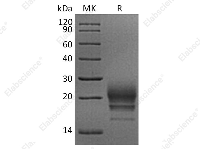 Recombinant Rhesus macaque CD160 Protein (His Tag) - 1