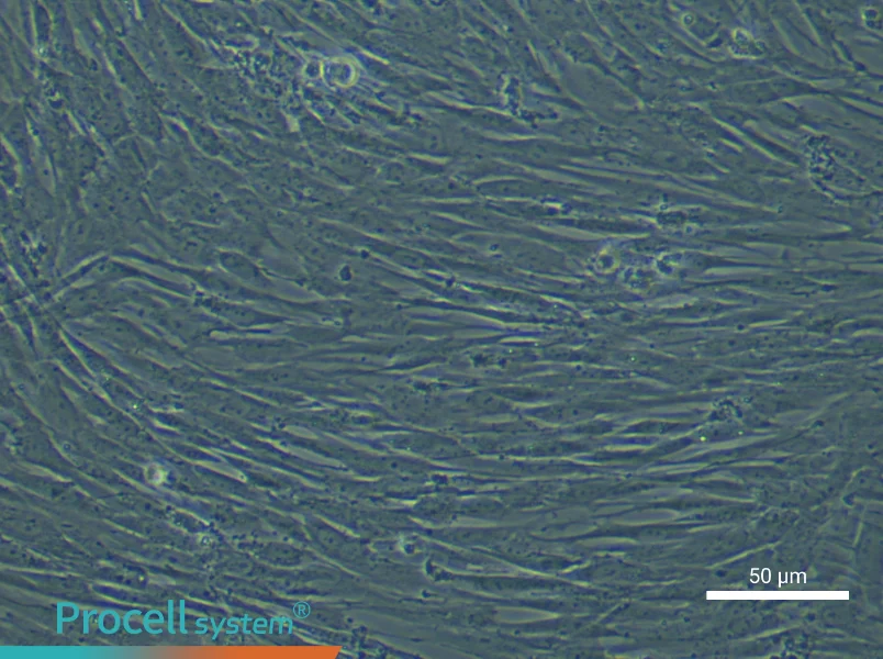Human Lung Fibroblast Complete Medium - small - 4