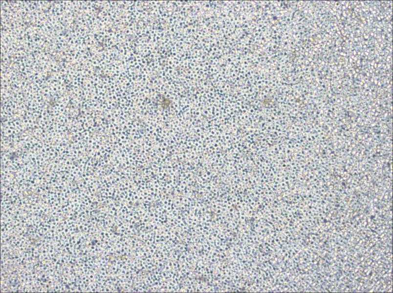 NOMO-1 Cell Complete Medium - 2