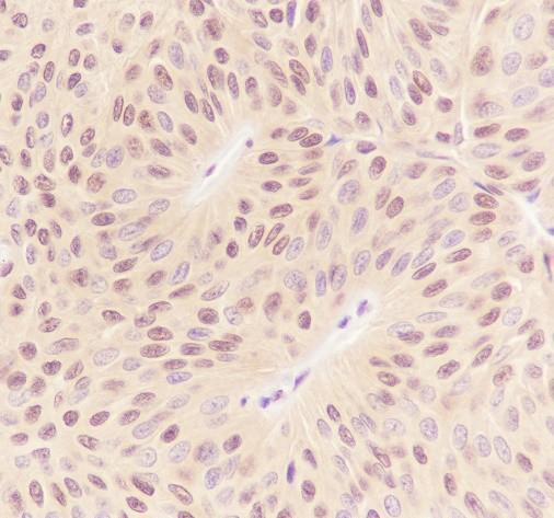 Recombinant RBX1 Monoclonal Antibody-searchlist-2
