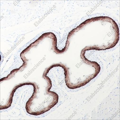 Recombinant Keratin 15 Monoclonal Antibody - 7