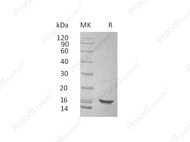 IL-10/IL10A, Human, Recombinant