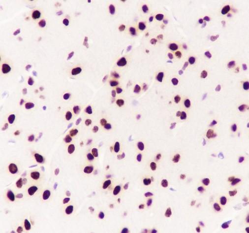 Recombinant CBX4 Monoclonal Antibody - small - 5