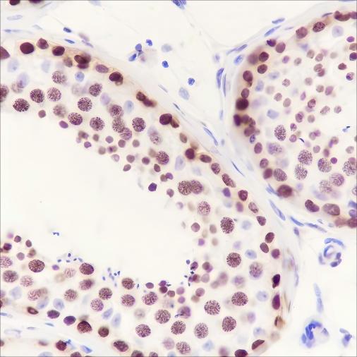 Recombinant HMGA1 Monoclonal Antibody - small - 5