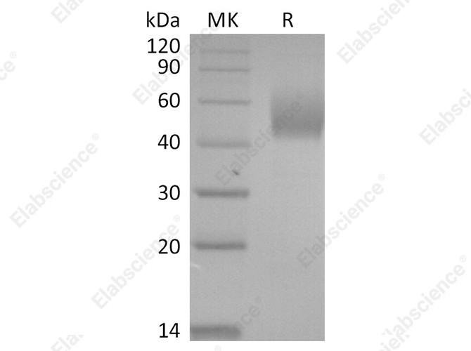 Recombinant SARS-CoV-2 Spike Protein (NTD, His Tag) - 1