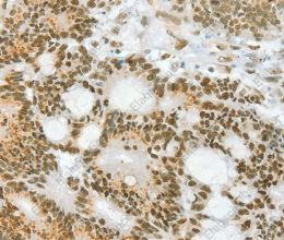 ANGPT4 Polyclonal Antibody - 3