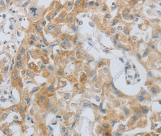 MMP25 Polyclonal Antibody - 2