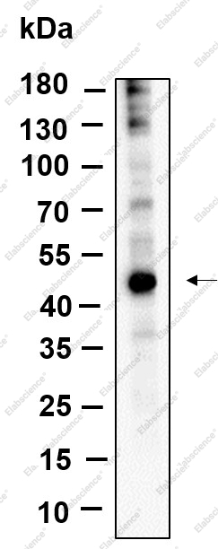 Recombinant YB-1 Monoclonal Antibody - 1