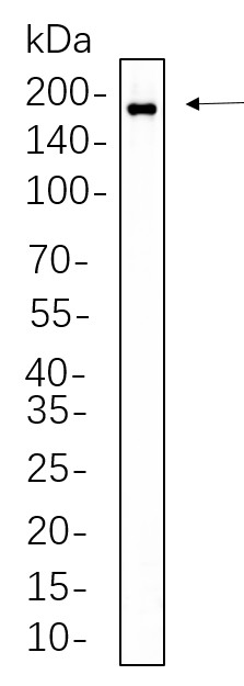 Recombinant Phospho-HER2 (Tyr1221, 1222) Monoclonal Antibody-searchlist-1