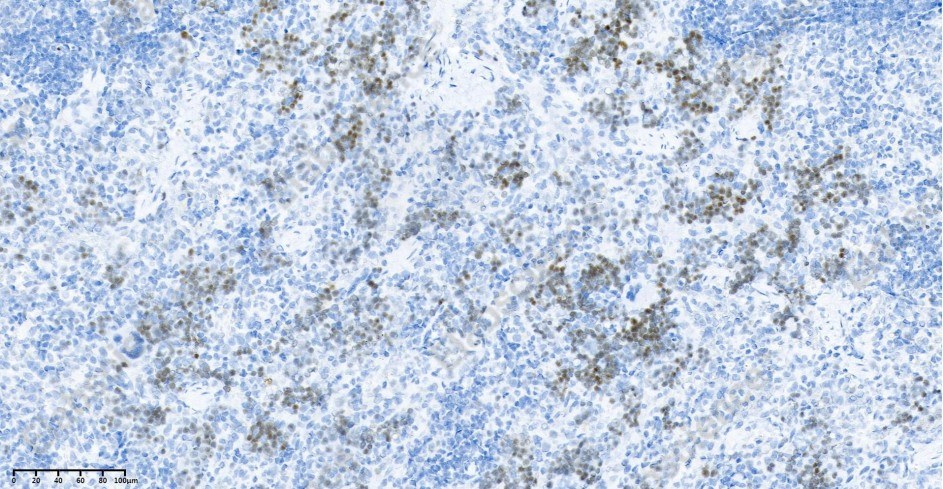 Recombinant Ki67 Monoclonal Antibody - 4
