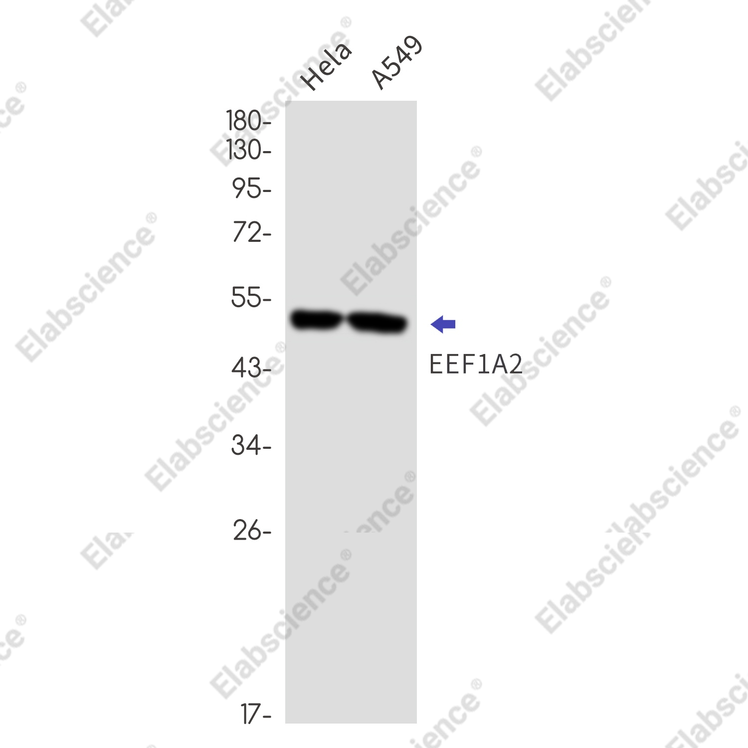 Recombinant Elongation Factor 1A2 Monoclonal Antibody - 2