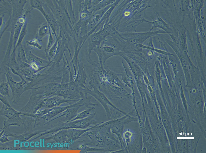 Mouse Pancreatic Stellate Cell Complete Medium - small - 6