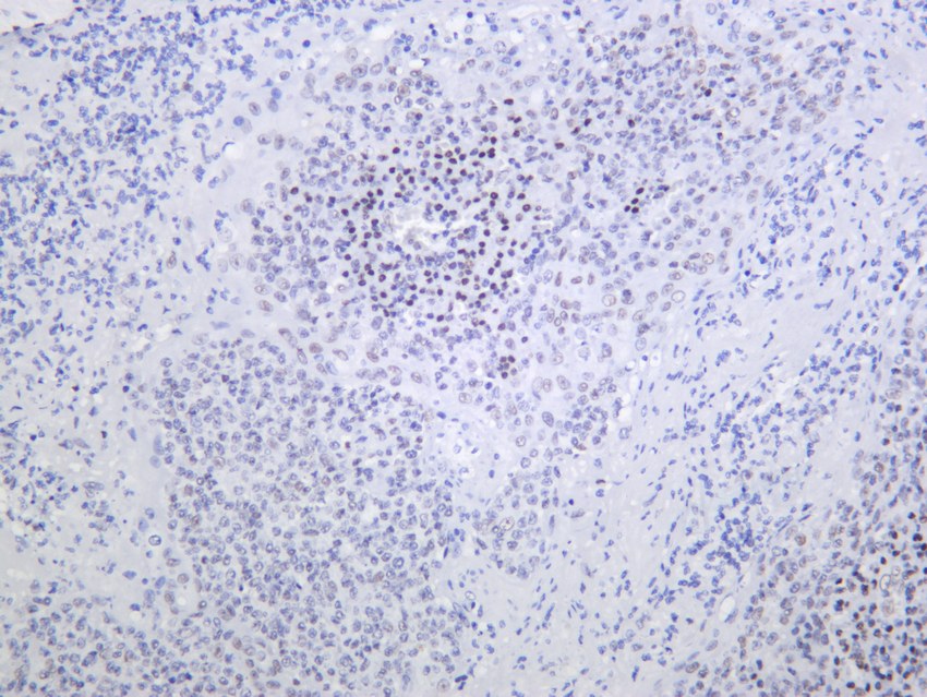 Recombinant BMI1 Monoclonal Antibody - 2