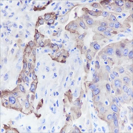 Recombinant Keratin 5/6 Monoclonal Antibody - small - 4
