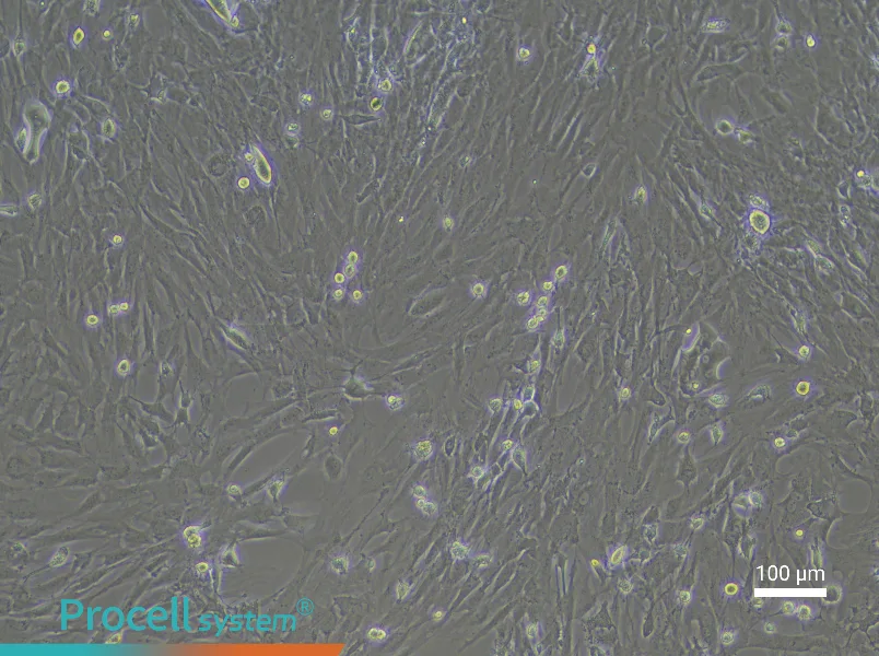 Rat Pancreatic Stellate Cell Complete Medium - 1