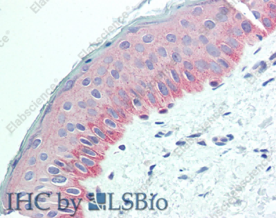 NECTIN4 Polyclonal Antibody - 5