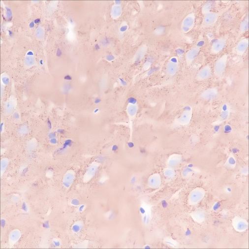 Recombinant Prion protein PrP Monoclonal Antibody - small - 4